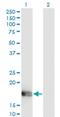 Olfactory Marker Protein antibody, H00004975-M01, Novus Biologicals, Western Blot image 