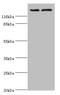 ATP Binding Cassette Subfamily B Member 1 antibody, A52229-100, Epigentek, Western Blot image 