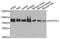 Suv3 Like RNA Helicase antibody, PA5-76460, Invitrogen Antibodies, Western Blot image 