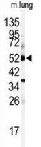 Cytochrome P450 Family 1 Subfamily A Member 1 antibody, GTX81231, GeneTex, Western Blot image 