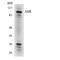 Aryl Hydrocarbon Receptor antibody, LS-B10220, Lifespan Biosciences, Western Blot image 
