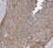 SEC61 Translocon Beta Subunit antibody, FNab07689, FineTest, Immunohistochemistry paraffin image 