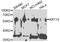 Keratin 10 antibody, STJ110217, St John