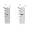 Glutathione Synthetase antibody, NBP2-57177, Novus Biologicals, Western Blot image 