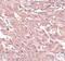 Breast Carcinoma Amplified Sequence 4 antibody, PA5-20907, Invitrogen Antibodies, Immunohistochemistry paraffin image 