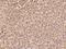 Propionyl-CoA Carboxylase Subunit Beta antibody, GTX02269, GeneTex, Immunohistochemistry paraffin image 