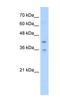 Transmembrane Protein 104 antibody, NBP1-59389, Novus Biologicals, Western Blot image 