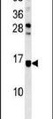 Ataxin 7 Like 3B antibody, PA5-23565, Invitrogen Antibodies, Western Blot image 