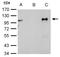 Nuclear Receptor Subfamily 3 Group C Member 1 antibody, GTX113208, GeneTex, Immunoprecipitation image 
