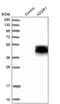 Asialoglycoprotein Receptor 1 antibody, PA5-52994, Invitrogen Antibodies, Western Blot image 