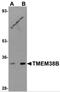 Transmembrane Protein 38B antibody, 5523, ProSci Inc, Western Blot image 