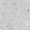 Cyclin Dependent Kinase 14 antibody, NBP1-80920, Novus Biologicals, Immunohistochemistry paraffin image 