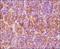 HIF1-alpha antibody, NB100-134, Novus Biologicals, Immunohistochemistry paraffin image 