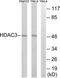 Histone Deacetylase 3 antibody, TA326123, Origene, Western Blot image 