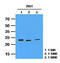 Hypoxanthine Phosphoribosyltransferase 1 antibody, MBS200197, MyBioSource, Western Blot image 