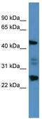 Oxidative Stress Induced Growth Inhibitor Family Member 2 antibody, TA342836, Origene, Western Blot image 