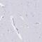 Myosin IF antibody, PA5-63096, Invitrogen Antibodies, Immunohistochemistry paraffin image 