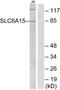 Solute Carrier Family 6 Member 15 antibody, PA5-39325, Invitrogen Antibodies, Western Blot image 