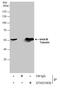 Tubulin Beta 3 Class III antibody, GTX631830, GeneTex, Immunoprecipitation image 