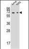 Dihydropyrimidinase antibody, PA5-48576, Invitrogen Antibodies, Western Blot image 