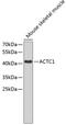 Actin Alpha Cardiac Muscle 1 antibody, 22-274, ProSci, Western Blot image 
