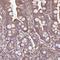 Glucosamine-6-Phosphate Deaminase 2 antibody, NBP2-33474, Novus Biologicals, Immunohistochemistry frozen image 