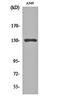 Mediator Complex Subunit 23 antibody, orb160589, Biorbyt, Western Blot image 
