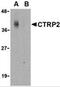 C1q And TNF Related 2 antibody, 3561, ProSci, Western Blot image 
