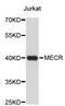 Mitochondrial Trans-2-Enoyl-CoA Reductase antibody, STJ26818, St John