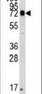 Heat Shock Protein Family A (Hsp70) Member 5 antibody, PA5-11418, Invitrogen Antibodies, Western Blot image 