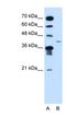 Microfibril Associated Protein 3 Like antibody, NBP1-70637, Novus Biologicals, Western Blot image 