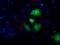 Aldehyde Dehydrogenase 3 Family Member A1 antibody, MA5-25098, Invitrogen Antibodies, Immunocytochemistry image 