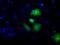 Aldh3 antibody, MA5-25098, Invitrogen Antibodies, Immunocytochemistry image 