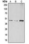 Abhydrolase Domain Containing 8 antibody, orb215287, Biorbyt, Western Blot image 
