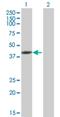 Tropomodulin 3 antibody, H00029766-B01P, Novus Biologicals, Western Blot image 