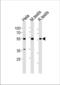 Histone Deacetylase 1 antibody, TA324609, Origene, Western Blot image 