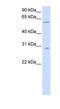 Patatin Like Phospholipase Domain Containing 4 antibody, NBP1-57925, Novus Biologicals, Western Blot image 