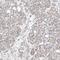 L37mt antibody, PA5-55258, Invitrogen Antibodies, Immunohistochemistry paraffin image 