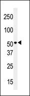 Solute Carrier Family 29 Member 4 antibody, GTX82547, GeneTex, Western Blot image 