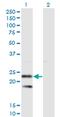 Signal Sequence Receptor Subunit 2 antibody, MA5-20028, Invitrogen Antibodies, Western Blot image 