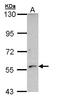 Cytochrome P450 Family 21 Subfamily A Member 2 antibody, LS-C109472, Lifespan Biosciences, Western Blot image 