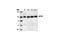 Eukaryotic Elongation Factor 2 Kinase antibody, 3692S, Cell Signaling Technology, Western Blot image 