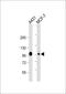Catenin Delta 1 antibody, A02333, Boster Biological Technology, Western Blot image 