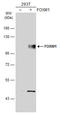 Forkhead Box M1 antibody, GTX102170, GeneTex, Western Blot image 