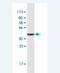 NPHS1 Adhesion Molecule, Nephrin antibody, H00004868-M02, Novus Biologicals, Western Blot image 