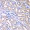 Aldehyde Dehydrogenase 1 Family Member A2 antibody, LS-C349196, Lifespan Biosciences, Immunohistochemistry frozen image 