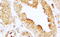 ATPase Sarcoplasmic/Endoplasmic Reticulum Ca2+ Transporting 2 antibody, 43-428, ProSci, Western Blot image 