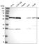 Heterogeneous nuclear ribonucleoprotein K antibody, HPA044105, Atlas Antibodies, Western Blot image 