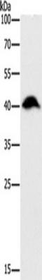 Adenosine Kinase antibody, TA349453, Origene, Western Blot image 