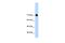 GTF2I Repeat Domain Containing 1 antibody, PA5-41579, Invitrogen Antibodies, Western Blot image 